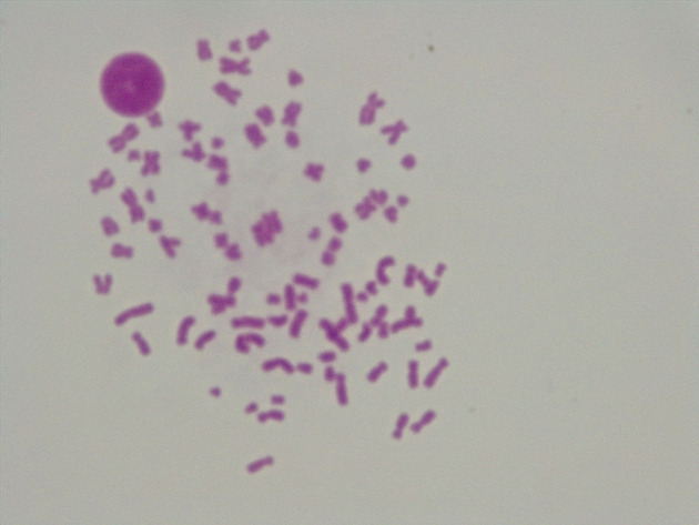 Female Chromosomes Slides - Female Chromosomes 09 1000X